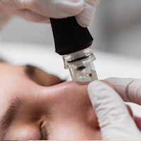 Kosmetikstudio ★ Schönheitssalon ★ Aqua Hydrafacial in der nähe Riedstadt  beauty by mel