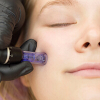  Kosmetikstudio ★ Schönheitssalon ★ Microneedling in der nähe Riedstadt  beauty by mel