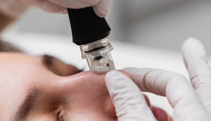Aqua Hydrafacial Kosmetikstudio in der nähe Geinsheim 